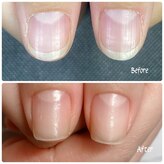 シッカネイル(sicca nail)