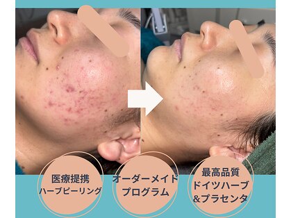 ノヴェイル 大濠店(NoVeil)の写真