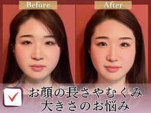 美妖庵の雰囲気（横浜で結婚式前の最終調整をお探しなら当店のブライダルエステ！）