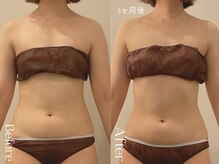 ユーフォリア グロウ(euphoria glow)/｛ ラフォス痩身120分 &nbsp;16回　｝