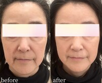 マーリィズエステティック(MARLEY'S AESTHETIC)