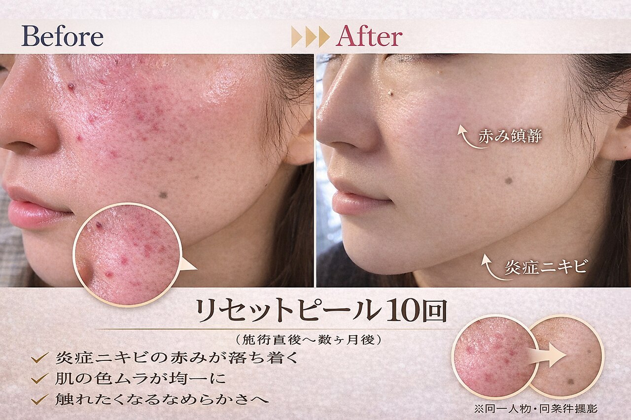 松阪市でEMSが人気のエステサロン｜ホットペッパービューティー