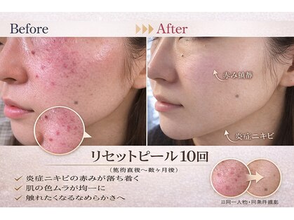 カラン(CALIN)の写真