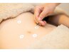 腸活巡り鍼灸60分【14300円→13000円】お通じ改善、胃の膨満感、体のだるさ