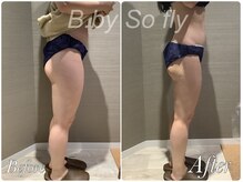 ビードット バイ ソーフライ(B.by So fly)/下半身集中コース☆