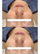 クレアナ ザ ビューティー(KULEANA the beauty)/光フォト+モデリングパック