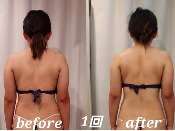 コリ チル(Kori Chill)/【ハイパーBefore→After】