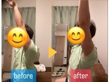 たすき鍼灸治療院/スポーツで痛めた肩痛