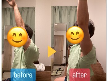 たすき鍼灸治療院/スポーツで痛めた肩痛