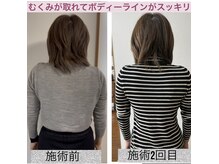 新リンパサロン 大阪