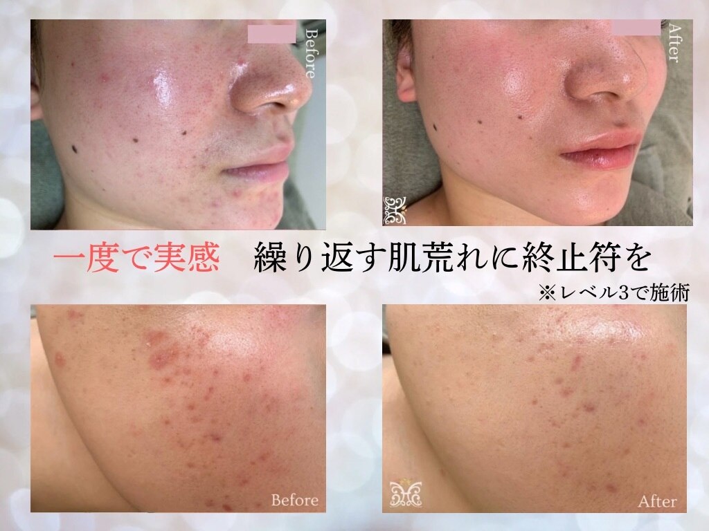 ヴィキ 北千住(VIKI)｜ホットペッパービューティー