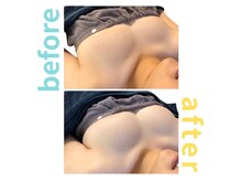 シエル(Ciel)/バストアップ施術１回