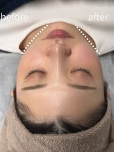 【小顔・痩身】小顔専門店Lift 川越/小顔専門店Lift l 痩身施術