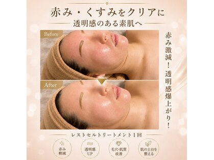 エソール(essor)の写真