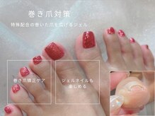 アンネ 梅田 ALLYS店(ANNE)の雰囲気（巻き爪矯正ジェル導入してます☆対策しながら可愛く♪ロアオイル）