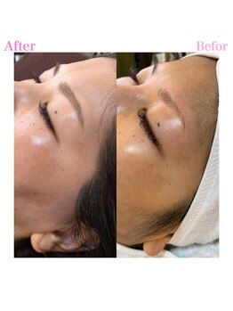 プリュスマイル(+Smile.)/フェイシャルワックス