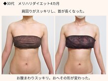 リクラ(Reclat)/お腹スッキリ、鎖骨もキレイ♪