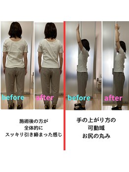 ミコット/新メニュー☆骨盤矯正若狭式