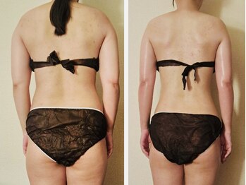 マナ(mana)/食べて痩せるダイエット