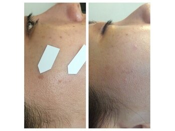 レイブルーノ(RayBruno)