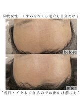ヴェルシック(Belchic)/くすみで悩む日々に終止符を