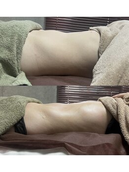 アディ(Adiy)/LINO式腸もみ×骨盤調整