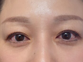 エイジレス(AGELESS)/ポイント→短くてもパッチリ感を