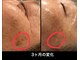 アミュレット(AMULET)の写真
