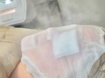 ビズビズ 梅田店(bisebise)の写真/毛穴じゅわっパワフルスチーム【ハイドラ毛穴洗浄￥6500】トルネード吸引×照射で毛穴キュッ角栓黒ずみゼロ