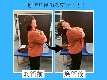 整体院リソーナ/施術後の変化