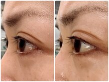 スーコ(SU:CO)の雰囲気（《日本初!眼球志筋術》目もホワイトニングでエイジングケア！）