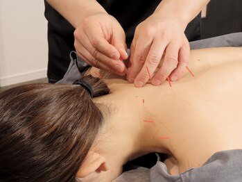 シンリュウ(SHIN-RYU)の写真/鍼灸院ぽくない鍼灸院はいかがですか?気軽に入りやすいプライベート空間で身体の悩みを解消♪