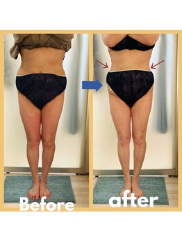 ビューティートワブルームサロン(Beauty Towabloom Salon)/一度でマイナス8センチダウン