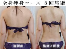 サンティエ(Santie)の雰囲気（痩身実績多数◎一度でもシルエットの変化実感）