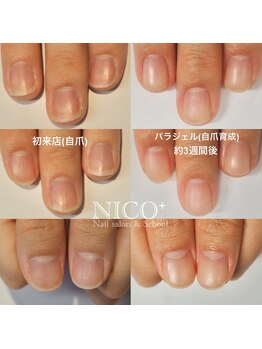 ニコプラス(NICO+)/自爪育成パラジェルクリア補強