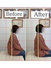 ナオル整体 仙台長町院(NAORU整体)/整体・矯正ビフォーアフター