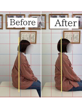 ナオル整体 仙台長町院(NAORU整体)/整体・矯正ビフォーアフター