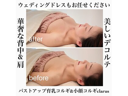 クラルス(clarus)の写真
