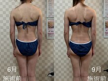 ハレオラ(HaleOla)/30代☆体重増えても美スタイル♪