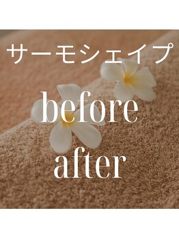 リラクゼーションサロン ラキ(laki)/痩身/サーモシェイプ