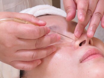 チアキ(CHIAKI)/小鼻の角栓吸引