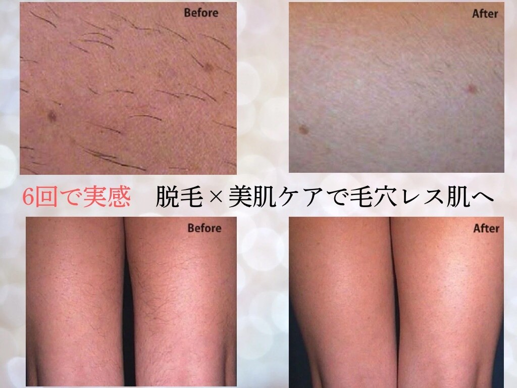 ヴィキ 北千住(VIKI)｜ホットペッパービューティー