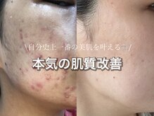 リリーラボ(LILY LAB)