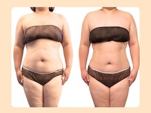 癒和(YUWA)/お腹周りと姿勢が整う痩身エステ