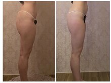 ルポーゼ(Repose)/