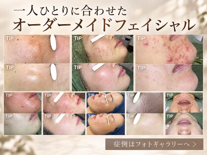 サンテ(Sante)の写真