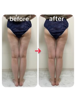 ルクール(Le Couer)/痩身【美尻美脚コース】