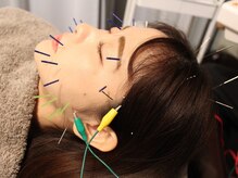 サボ 表参道 原宿(SABO)/電気美容鍼｜美容鍼×整体SABO