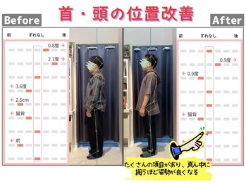 しのまる整体/<グループ院事例>首、頭位置改善