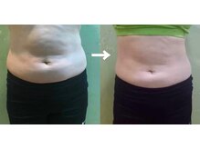 ラディアンス/トーンヌールダイエット　2